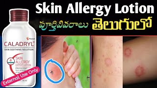 Caladryl Skin Soothing Solution  Review In Telugu l All Kinds Of Skin Allergies [upl. by Brunhild]