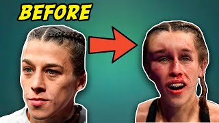 Massive Hematoma Doctor Explains Joanna Jedrzejczyk Forehead at UFC 248 [upl. by Shela]