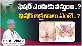 Fissures in Telugu  Signs and Symptoms of Fissure  How to Get Rid of Fissure Pain  One Hospital [upl. by Tulley]