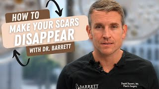 How To Make Your Scars Disappear  Barrett Plastic Surgery [upl. by Nitsirt540]