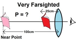 Physics  Optics Vision Correction 5 of 5 Very Farsighted [upl. by Ahsien]