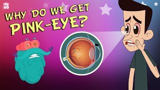 What Causes Conjunctivitis  CONJUNCTIVITIS  PinkEye  The Dr Binocs Show  Peekaboo Kidz [upl. by Errot]