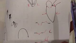 guyton chapter 23 part 1 of 3  heart sounds [upl. by Jehiah]