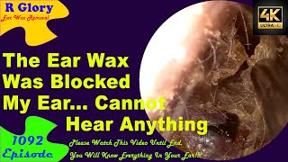 The Ear Wax Was Blocked My Ear🤷‍♂️New Video Ear Wax Removal 1092😍 ear newvideo earwax [upl. by Louisa]