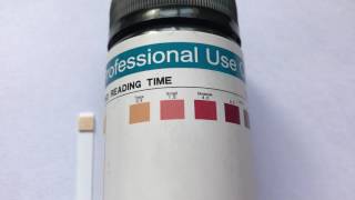 How to read ketone test strip results What are normal ketone levels [upl. by Nahtnaoj393]