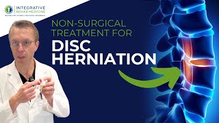 Herniated amp Bulging Disc Treatment Without Surgery Ozone Therapy is Safe and Effective [upl. by Mose]