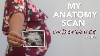 20 Week Anatomy Scan What to Expect  Tips [upl. by Aisya456]