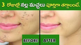 How To Remove Black Spots On Face In Telugu  Latest 2018  Beauty Tips In Telugu  Star Telugu YVC [upl. by Airdnna]