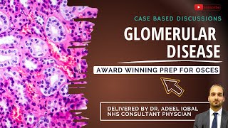 Glomerular Disease  Abdominal  BEST OSCE Preparation for Medical Student Exams [upl. by Otrebide956]