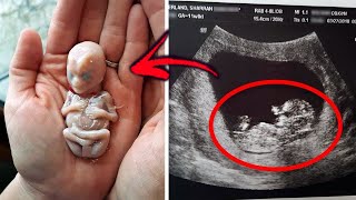 10 Most BIZARRE Babies That Were Born Different [upl. by Aihcropal]