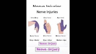 nerve injuriesnuerologycnspnsmedicose medicine Sudarshanlipane17 🍀⛑️⛑️🏥🩺🩺💊💉💉 [upl. by Nirol953]