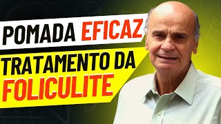 Pomada para foliculite Conheça o MELHOR tratamento [upl. by Lore]