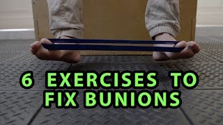 6 Exercises to Fix Bunions [upl. by Neema]