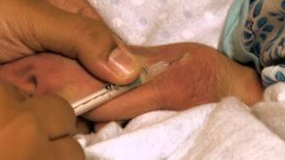 Giving an Intradermal Injection Swahili  Newborn Care Series [upl. by Blanchard]