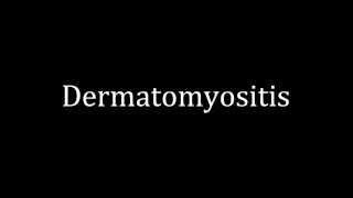 How to pronounce Dermatomyositis [upl. by Kentigerma]