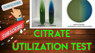 Citrate utilization test।। Microbiology in hindi [upl. by Vivia]