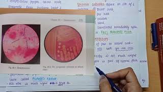 Streptococcus Pyogenes  Morphology  Virulence factors  culture amp lab diagnosis  MICROBIOLOGY [upl. by Mairim]