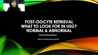 Post oocyte retrieval What to look for in USG [upl. by Gav]