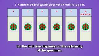 09 Nano amp Micro cell block discs after tissue processing Instructions to histotechnologists [upl. by Wylma]