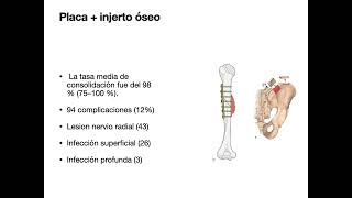 Tratamiento pseudoartrosis de Húmero [upl. by Munshi]