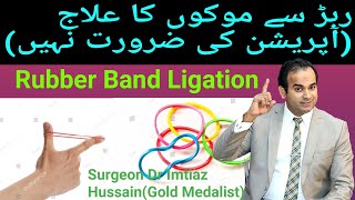 Rubber Band Ligation  آپریشن کے بغیر موکۓ کا علاج  Non Surgical Treatment of Piles Haemorrhoids [upl. by Dekeles]