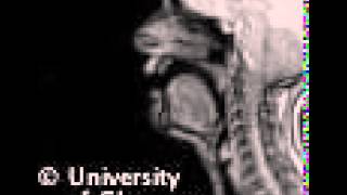 MRI voiceless palatal fricative [upl. by Studner]