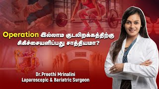 குடலிறக்கத்திற்கு இது மட்டும் தான் Solution  Treatment for Hernia [upl. by Suivatra]