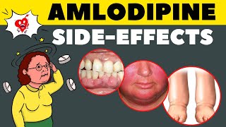 Amlodipine Side Effects amp How to Avoid  Amlodipine Adverse Effects [upl. by Nnylsoj264]