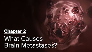 What Causes Brain Metastases Chapter 2 — Brain Metastases A Documentary [upl. by Tine]