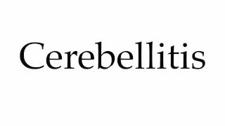 How to Pronounce Cerebellitis [upl. by Buffo]