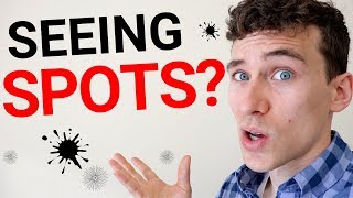 Eye Floaters  7 Reasons You See Spots in Your Vision [upl. by Eustazio]