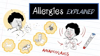 What are Allergies HealthSketch [upl. by Coulter]