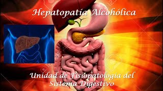 Hepatopatía Alcohólica [upl. by Atiras]