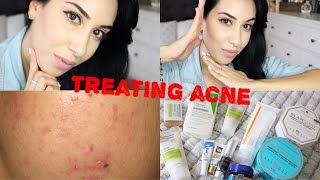 Daily Skin Care Routine ♥ Get Rid Of Acne amp Scars [upl. by Ecitnerp]