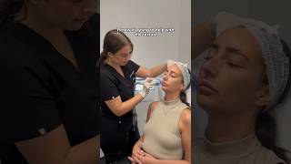 From Skin Assessment to Radio Frequency Microneedling at Dr Medispa Knightsbridge [upl. by Gord]