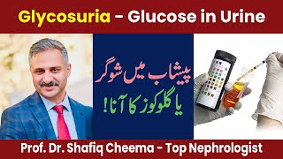 Glycosuria  Glucose in Urine [upl. by Adnerol916]