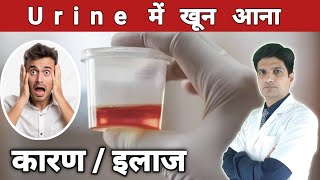 Urine me Blood aana  कारण लक्षण इलाज । Hematuria treatment [upl. by Gervase577]