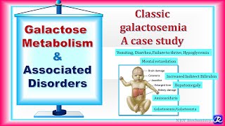 22 Galactose metabolism amp Associated Disorders  carbohydrates Metabolism  Biochemistry [upl. by Oremo222]