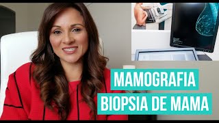 MAMOGRAFIA  BIOPSIA DE SENO Mi experiencia [upl. by Bouchard]