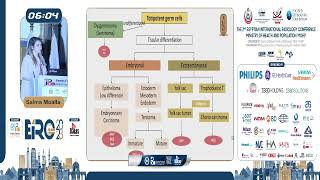 Adnexal Masses in Children and Adolescent [upl. by Lottie]