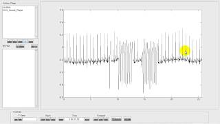 MATLABdigiscope ECG Sound Player [upl. by Ursola269]