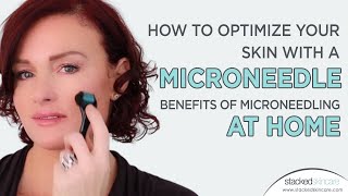 How To Optimize Your Skin With A Microneedle  Benefits Of Microneedling At Home [upl. by Pelagias]