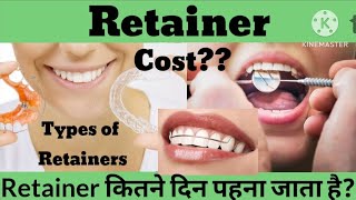 Retainer after braces Retainer on teeth Retainer Cost and Types Retainer कितने समय तक पहना पड़ेगा [upl. by Aivatal]