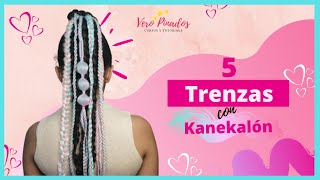 🦄 COLETA CON KANEKALON  5 trenzas diferentes  peinados para niñas [upl. by Dory]