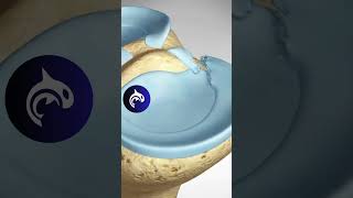 See how a Meniscus Root Repair of the Knee works  3D animation meniscus [upl. by Ahsiemal931]