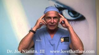 Botox Injection to Temporalis Muscle for TMJ and Migraine by Dr Joe Niamtu III [upl. by Terence]