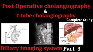 Ttube cholangiography  Post operative cholangiography  Biliary imaging system part 3 [upl. by Corwin]