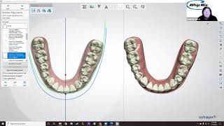 Webinar Indirect Bonding Using 3Shape Ortho Analyzer with Matthew Davis [upl. by Isyak436]