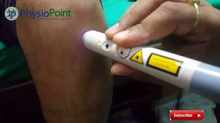 Patella Tendonitis Jumpers Knee Live Knee pain laser treatment [upl. by Orva]