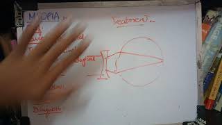 MYOPIA important concept made easy part 2 [upl. by Nylsirhc799]